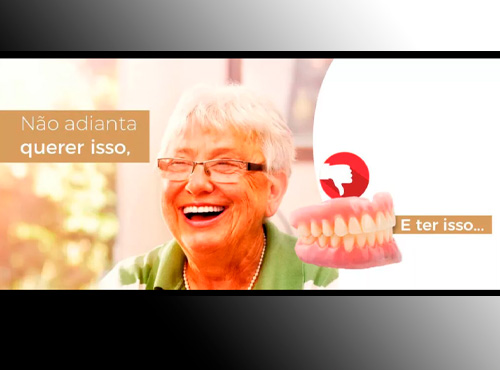 Como ter todos seus dentes fixos na boca