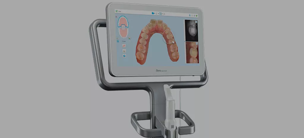 Invisalign com o iTero